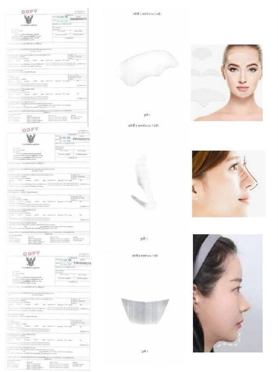 Patented Medical Facial Silicone Implant Business